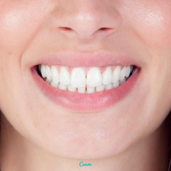 (№5) тренировка Фитнесклуба от морщин вокруг губ, реминерализации зубов от кариеса, выращиванию зубов